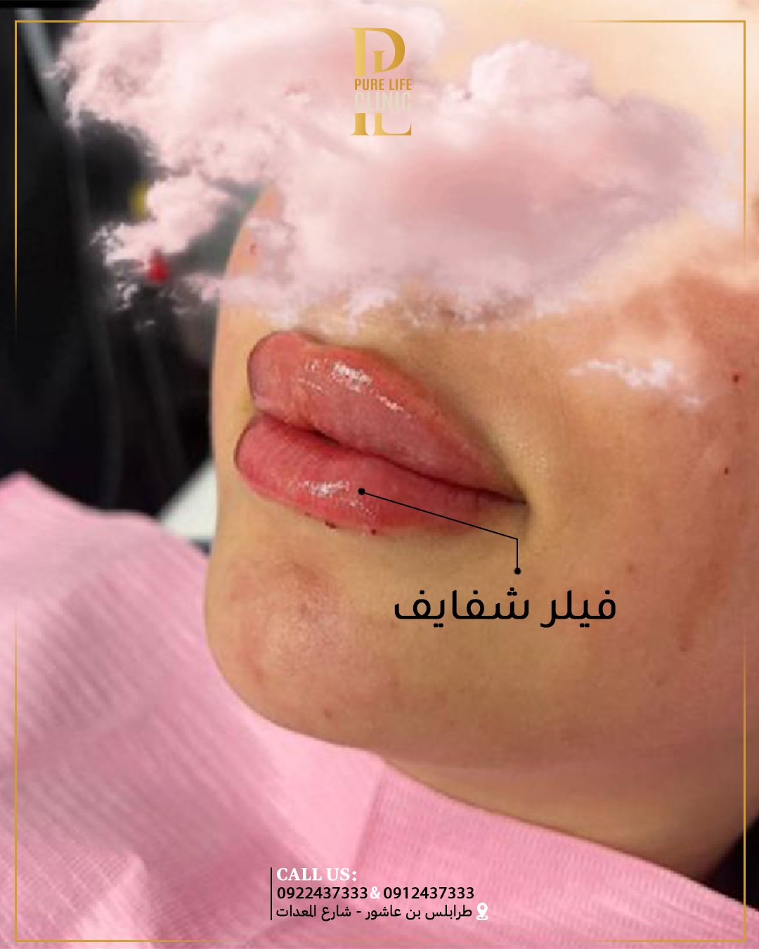 فيلر شفاييف