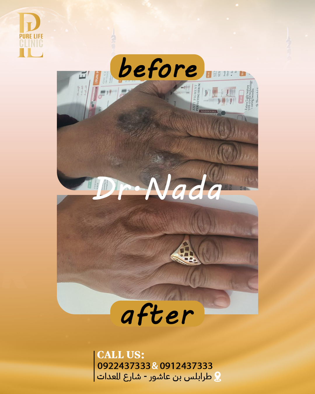 عالج تصبغات البشرة