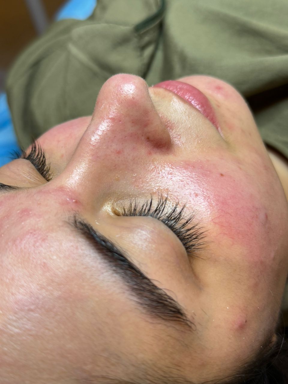 هيدرافيشيل (تنظيف بشرة)